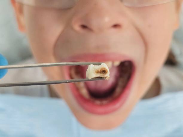 Best After-Hours Dental Trauma Care in Cotati, CA
