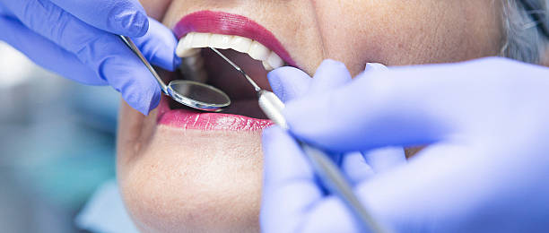 Best Emergency Treatment for Dental Infections or Abscesses in Cotati, CA
